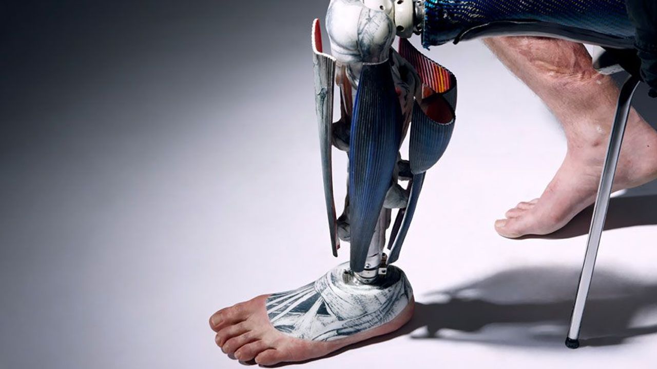 Prosthetics: Meet the man with 13 legs - BBC Future