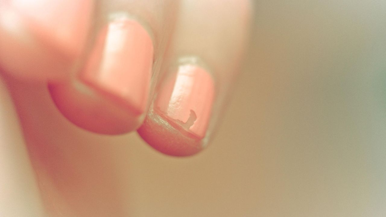 How to Stop Nail Biting After 20 Years This Is How I Finally Broke My  Biting Habit