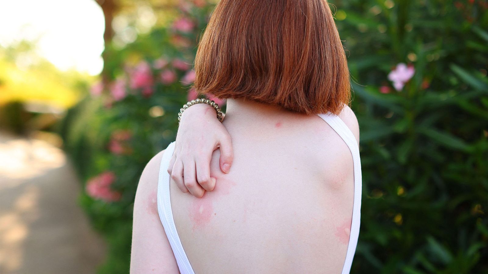 Mosquitoes identify victims via a cascade of cues, including skin and breath odours (Credit: Alamy)