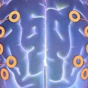 Brain trace 'can detect autism' thumbnail