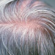 Can stress turn your hair grey? thumbnail