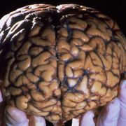 Brains that live on after death thumbnail