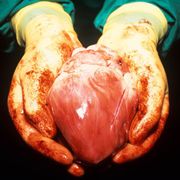Could pig transplants save lives? thumbnail