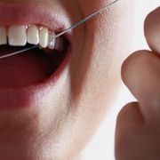 Do you really need to floss? thumbnail