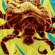 Why you are more bug than human thumbnail