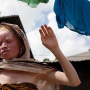 The ‘silent killer’ of Africa’s albinos thumbnail