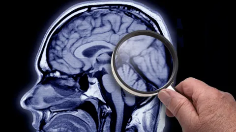 Does the brain ever rest?