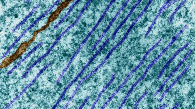 Microtubuli all'interno di una cellula (Credit: Dennis Kunkel Microscopy/Science Photo Library)