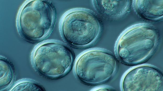 BBC - Earth - The largest, and smallest, sex cells on the planet