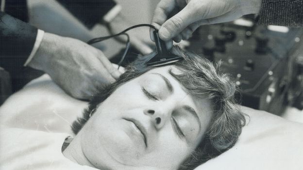 Electro-shock therapy sees a resurgence