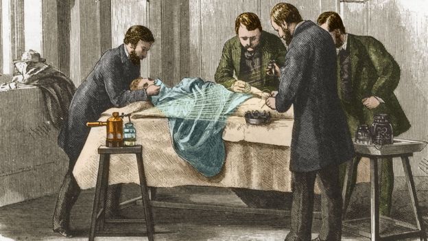 The pioneering surgeons who cleaned up filthy hospitals - BBC Future