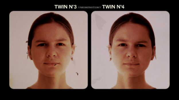 The Identical Twins Who Discovered Their Secret Sibling