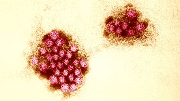 A genetic quirk protects some people from norovirus. Can vaccines help the rest of us?