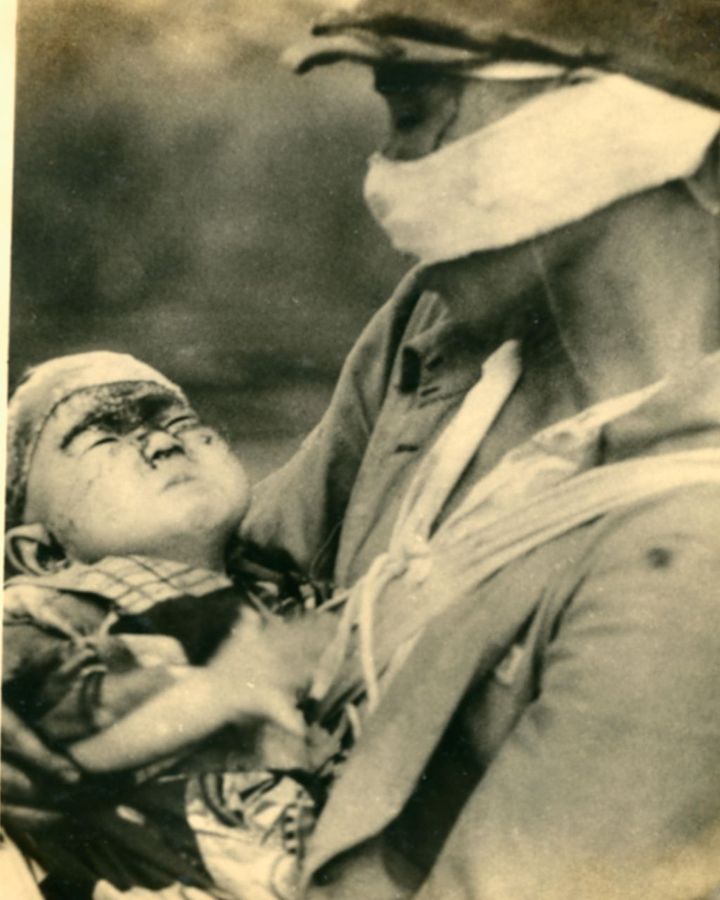 A wounded child in Hiroshima (Credit: Alamy)