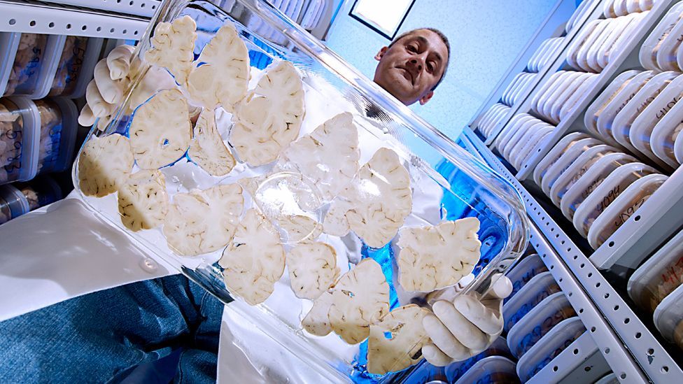 (Copyright: Science Photo Library)