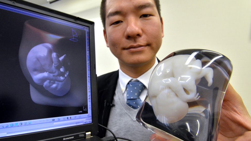 Japan’s Fasotec lets prospective parents create a 3D resin model of their unborn baby – which they can then buy to show friends and family. (Copyright: AFP/Getty Images) Japan’s Fasotec lets prospective parents create a 3D resin model of their unborn baby – which they can then buy to show friends and family. (Copyright: AFP/Getty Images)