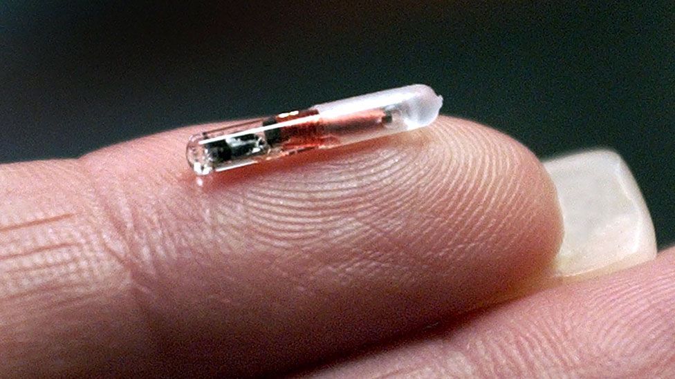 This chip, manufactured in the early 2000s by a company called VeriChip, stores personal medical information. (Rhona Wise/AFP/Getty) This chip, manufactured in the early 2000s by a company called VeriChip, stores personal medical information. (Rhona Wise/AFP/Getty)
