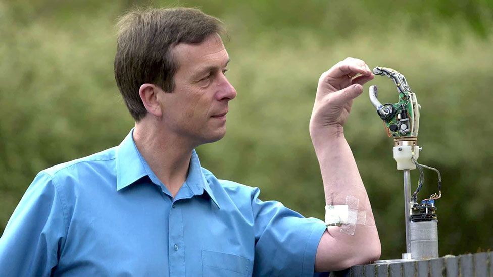 British researcher Kevin Warwick was one of the first people to have a chip implanted – in his forearm. (Rex Features)