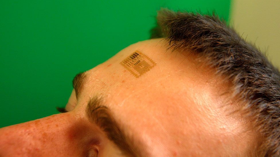 An alternative to implanted chips is the “electronic tattoo”, an adhesive worn on the skin. (John Rogers Research Group)