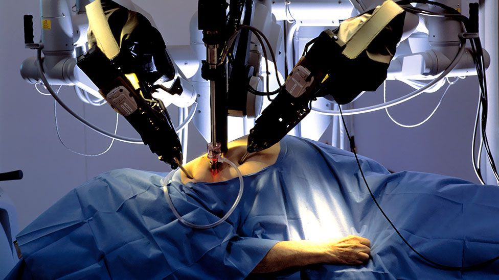 robot-assisted-surgery-introduced-at-united-hospital-spectrum-health