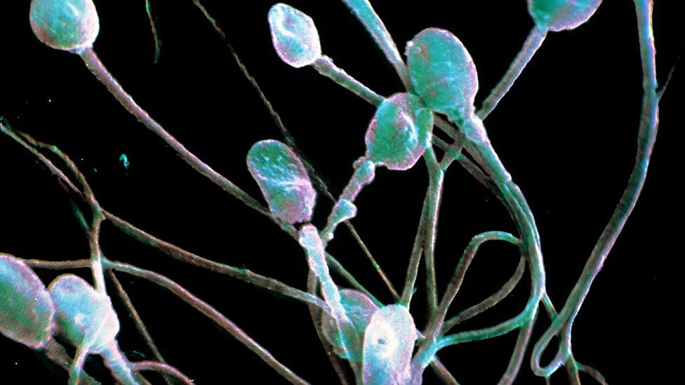 Sperm is usually necessary for reproduction - but it can come from other sources than men (SPL) Sperm is usually necessary for reproduction - but it can come from other sources than men (SPL)