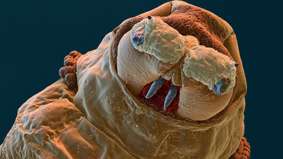 Микробы страшные фото