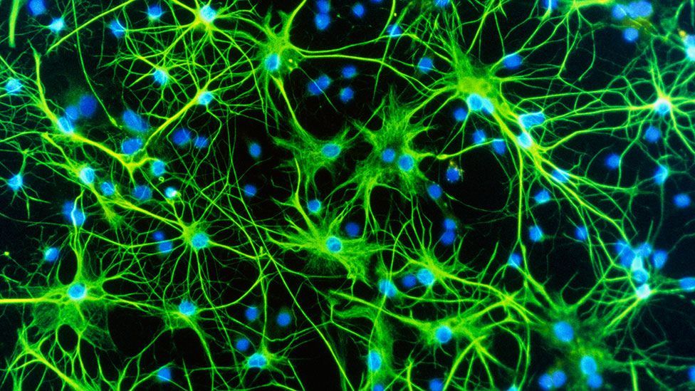 Like the slime mould, the human brain is a powerful network of 86 billion neurons (Science Photo Library) Like the slime mould, the human brain is a powerful network of 86 billion neurons (Science Photo Library)