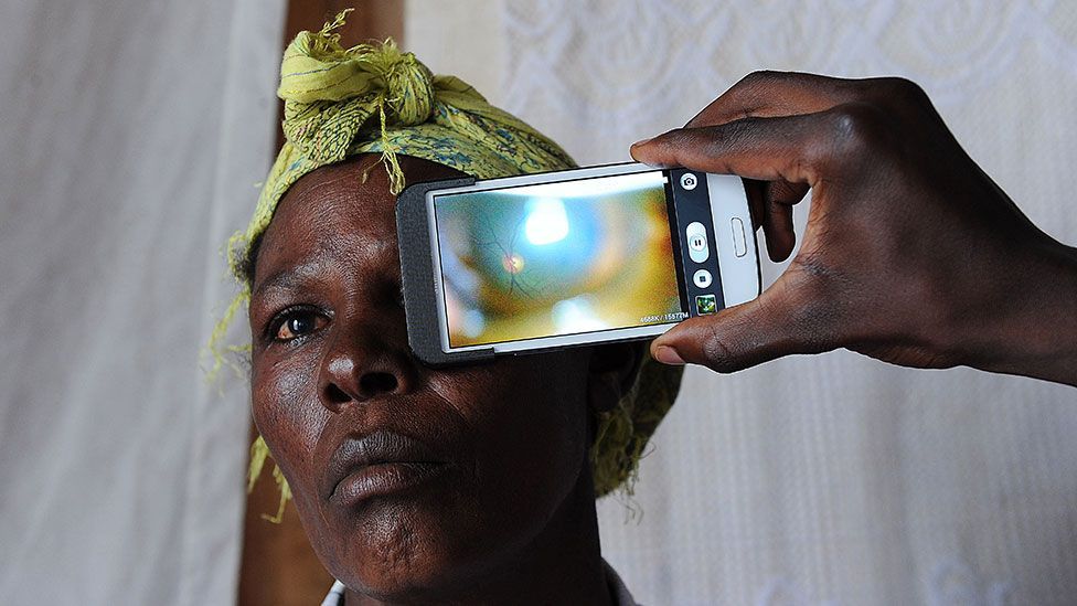 Smartphone cameras can also detect eye disease (Tony Karumba/AFP)