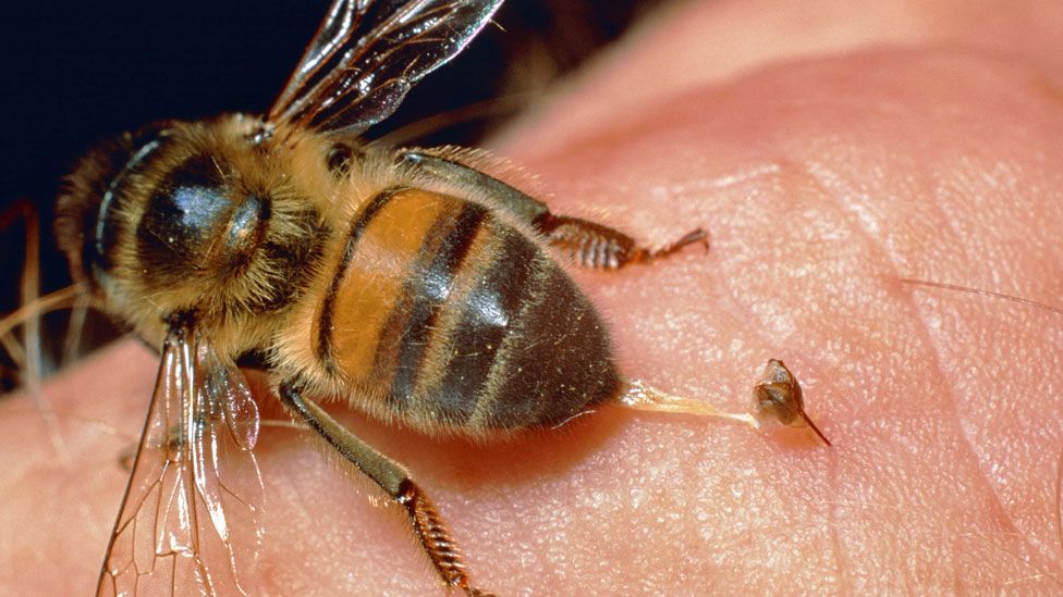 how-to-treat-a-bee-sting-at-home-and-when-to-head-to-the-hospital