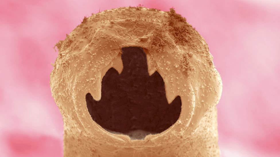 Do allergic reactions stem from our body’s reactions to parasitic worms? (Credit: Science Photo Library) Do allergic reactions stem from our body’s reactions to parasitic worms? (Credit: Science Photo Library)