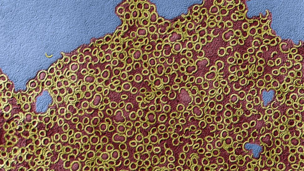 Bacteria convert the haemoglobin in blood into sulfhaemoglobin (Credit: Science Photo Library)