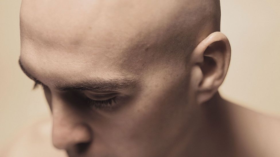 One doctor's gruesome way to banish baldness - BBC Future