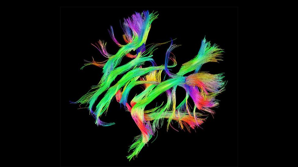The Human Connectome Project that shows the white-matter networks in our brains has been described as ‘the final frontier’ in cartography (Credit: www.humanconnectomeproject.org) The Human Connectome Project that shows the white-matter networks in our brains has been described as ‘the final frontier’ in cartography (Credit: www.humanconnectomeproject.org)
