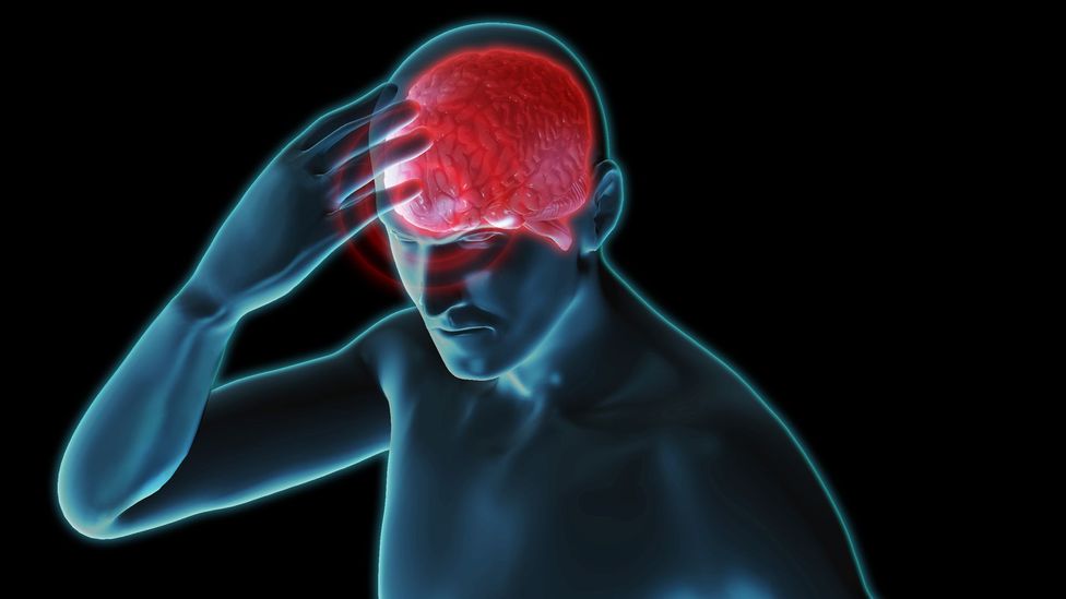 Migraines may become less severe as we age, research suggests (Credit: Science Photo Library) Migraines may become less severe as we age, research suggests (Credit: Science Photo Library)