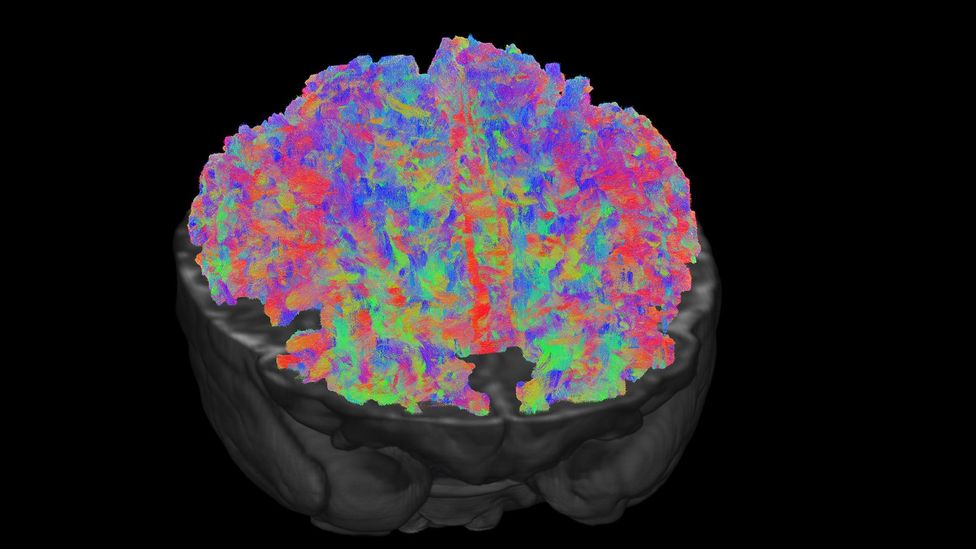 The scanners can record 10 million tracts in the newborn brain, which together form the building blocks for the baby's budding skills (Credit: dHCP)