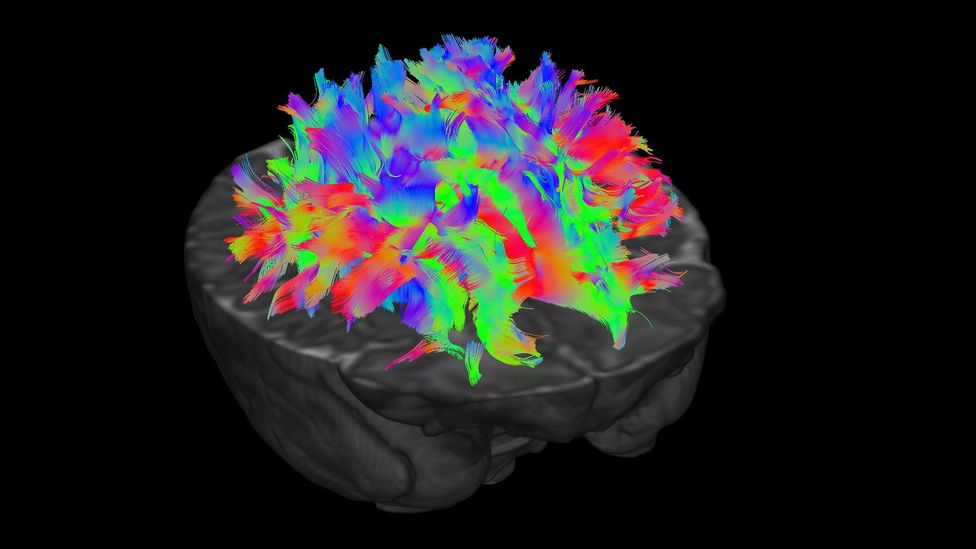 The different colours represent fibres travelling in different directions, so the scientists can pick apart which pathways connect which parts of the brain (Credit: dHCP)