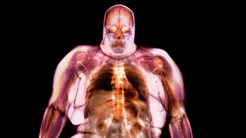 Tiny particles irritating the lungs may set off a cascade of reactions throughout the body, disrupting the hormones that control appetite (Credit: Science Photo Library) Tiny particles irritating the lungs may set off a cascade of reactions throughout the body, disrupting the hormones that control appetite (Credit: Science Photo Library)