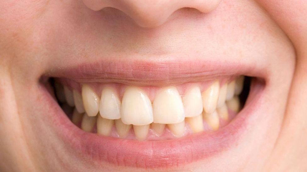 Tea’s natural pigments are more likely to adhere to dental enamel than coffee’s, dentists say (Credit: Getty Images)