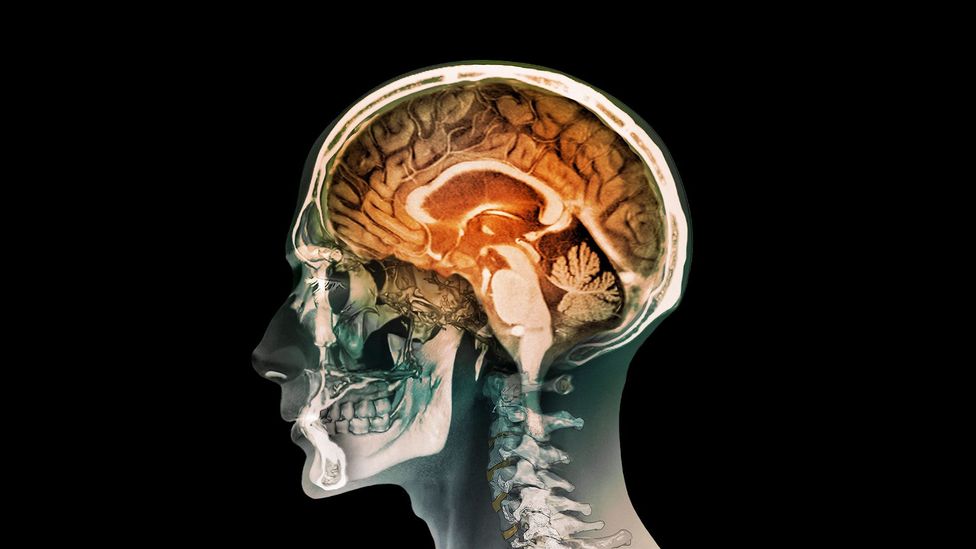 It is easy to underestimate the brain's power over the body (Credit: Getty Images)