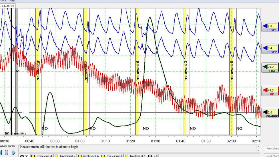 (Credit: Gazit Polygraph Institute)