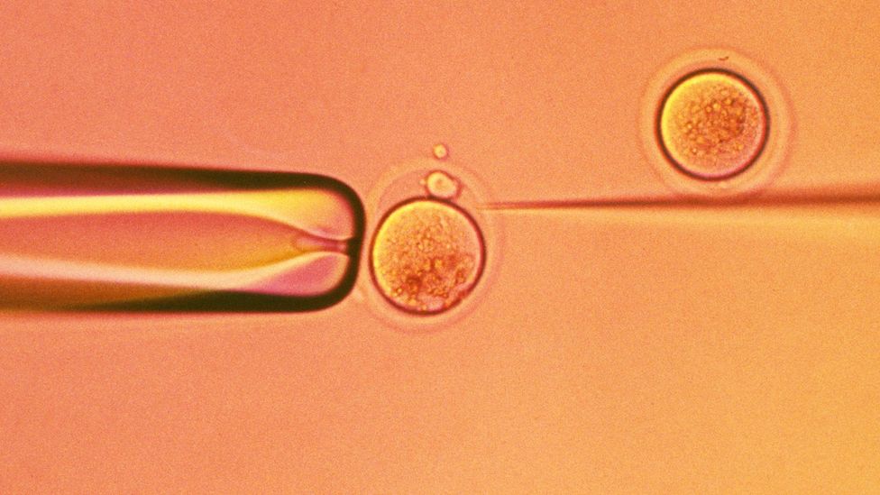 In Israel, state health insurance can fund IVF cycles using sperm extracted without specific written consent (Credit: SPL) In Israel, state health insurance can fund IVF cycles using sperm extracted without specific written consent (Credit: SPL)