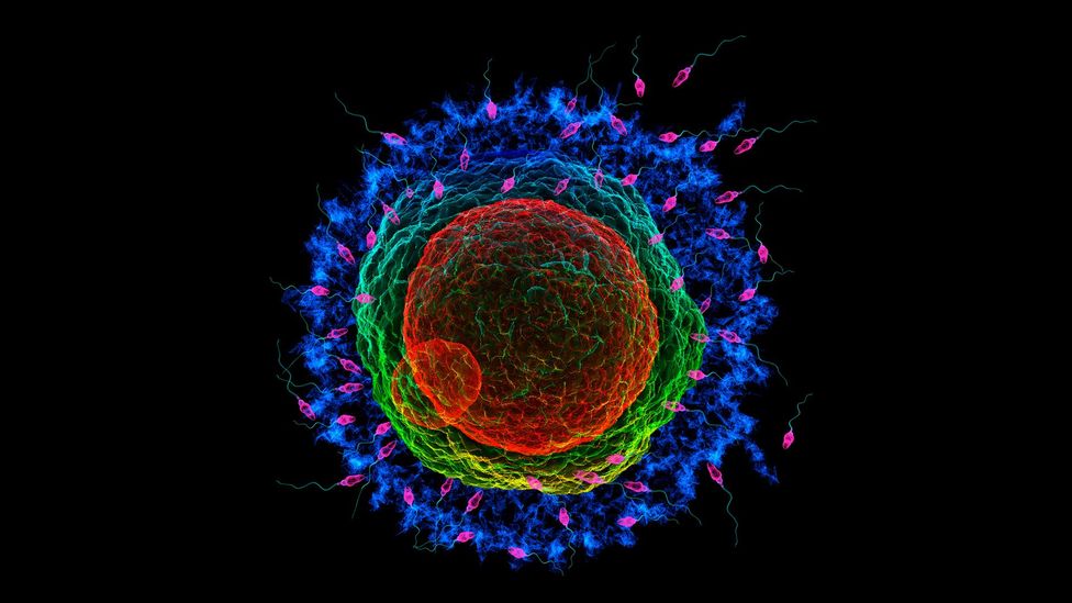 How should doctors and review boards weigh up decisions on fertilisation from post-mortem sperm extraction? (Credit: SPL) How should doctors and review boards weigh up decisions on fertilisation from post-mortem sperm extraction? (Credit: SPL)