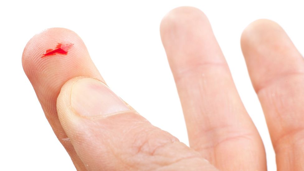 Why Paper Cuts Hurt So Much c Future