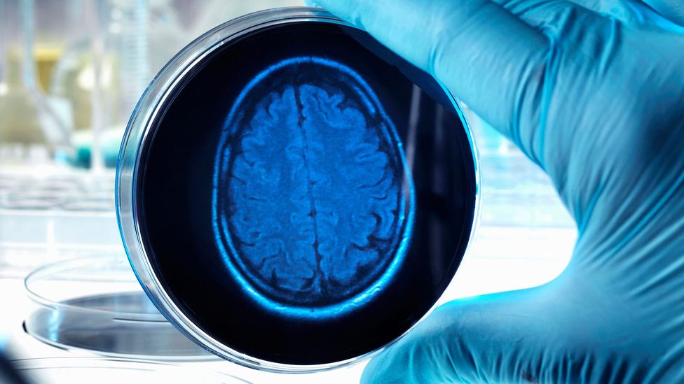 The tiny brains cannot "think" because they do not have a body with which to help process information (Credit: iStock) The tiny brains cannot "think" because they do not have a body with which to help process information (Credit: iStock)