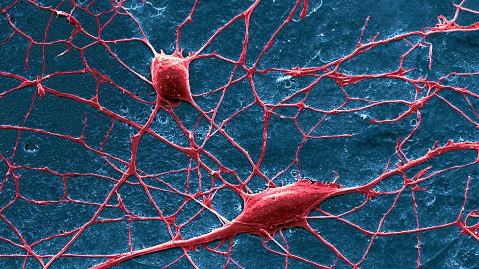 Pain is transmitted by nerve cells from the limbs to the spinal cord and from there to the brain (Credit: David McCarthy/Science Photo Library) Pain is transmitted by nerve cells from the limbs to the spinal cord and from there to the brain (Credit: David McCarthy/Science Photo Library)
