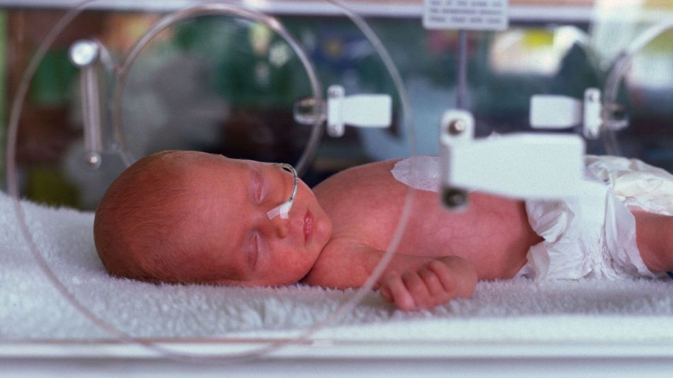 Premature babies given breastmilk are less likely to develop gut problems and severe infections like sepsis (Credit: Alamy)