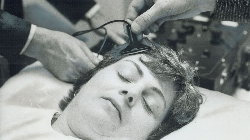 electroshock therapy 1950s