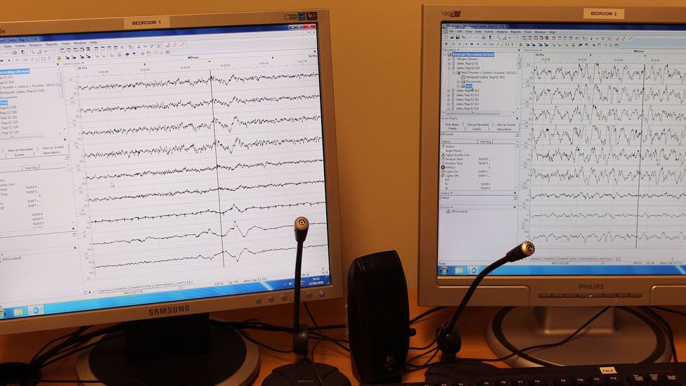 While a participant is sleeping, researchers can see activity in different regions of the brain (Credit: Christine Ro) While a participant is sleeping, researchers can see activity in different regions of the brain (Credit: Christine Ro)