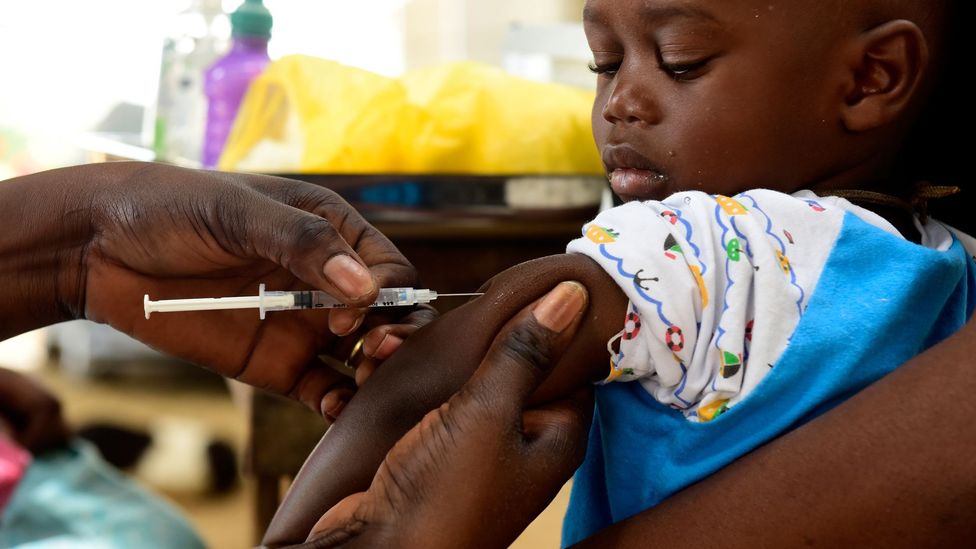 Measles can lead to subacute sclerosing panencephalitis, the symptoms of which resemble nodding syndrome - another reason why vaccination is important (Credit: Getty Images) Measles can lead to subacute sclerosing panencephalitis, the symptoms of which resemble nodding syndrome - another reason why vaccination is important (Credit: Getty Images)