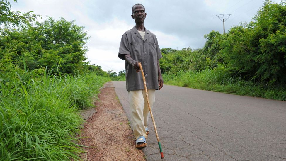 Nodding syndrome was once thought to be caused by the same parasitic worms that also lead to river blindness (Credit: Getty Images) Nodding syndrome was once thought to be caused by the same parasitic worms that also lead to river blindness (Credit: Getty Images)